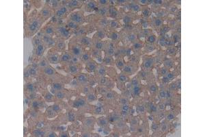 IHC-P analysis of Mouse Tissue, with DAB staining. (IL-6 Receptor Antikörper  (AA 52-204))