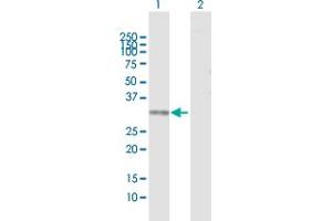Western Blot analysis of TYMS expression in transfected 293T cell line by TYMS MaxPab polyclonal antibody.