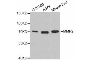 Western blot analysis of extracts of various cell lines, using MMP2 antibody. (MMP2 Antikörper)
