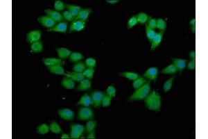 Immunofluorescence staining of Hela cells with ABIN7168176 at 1:66, counter-stained with DAPI. (RPS6KA2 Antikörper  (AA 228-395))