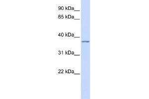 WB Suggested Anti-KCNAB2 Antibody Titration:  0. (KCNAB2 Antikörper  (Middle Region))