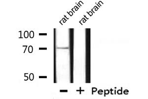 GUCY1B3 Antikörper  (N-Term)