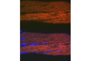 Immunofluorescence analysis of rat bone marrow cells using SERC/ Rabbit mAb (9639) at dilution of 1:100 (40x lens). (ATP2A1/SERCA1 Antikörper)