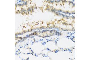 Immunohistochemistry of paraffin-embedded mouse lung using IFNL3 antibody at dilution of 1:100 (40x lens). (IL28B Antikörper)