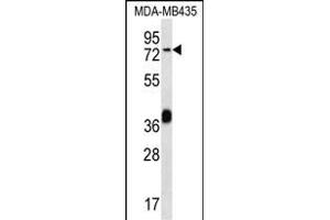 CEL Antibody (Center) (ABIN656486 and ABIN2837867) western blot analysis in MDA-M cell line lysates (35 μg/lane). (Cholesterol Esterase Antikörper  (AA 454-482))