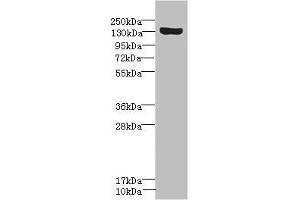 Western blot All lanes: SCN8A antibody IgG at 1. (SCN8A Antikörper  (AA 1350-1440))