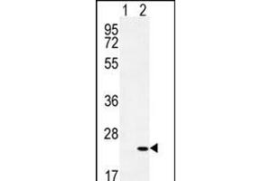 Western blot analysis of CRH (arrow) using rabbit polyclonal CRH Antibody (C-term) (ABIN655191 and ABIN2844807). (CRH Antikörper  (C-Term))
