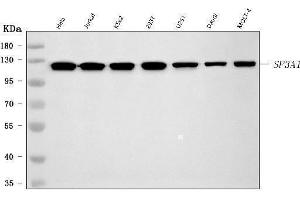 Western blot analysis of SF3A1 using anti-SF3A1 antibody (ABIN7600556). (SF3A1 Antikörper  (AA 20-556))
