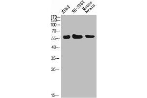Western Blot analysis of K562 SH-SY5Y mouse-brain cells using E-Selectin Polyclonal Antibody diluted at 1:500.