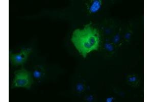 Anti-DYNC1LI1 mouse monoclonal antibody (ABIN2452965) immunofluorescent staining of COS7 cells transiently transfected by pCMV6-ENTRY DYNC1LI1 (RC222010). (DYNC1LI1 Antikörper)