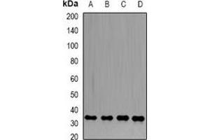 Western blot analysis of PP1 beta expression in HL60 (A), PC3 (B), Hela (C), mouse heart (D) whole cell lysates.