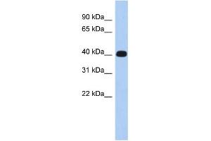 WB Suggested Anti-KIAA1189 Antibody Titration: 0. (ERMN Antikörper  (Middle Region))