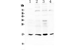 Western blot analysis of IL17B using anti-IL17B antibody . (IL17B Antikörper  (AA 21-180))