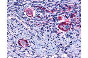 Anti-NUR77 antibody IHC of human ovary. (NR4A1 Antikörper  (N-Term))