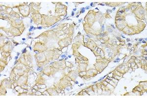 Immunohistochemistry of paraffin-embedded Human stomach using SPTAN1 Polyclonal Antibody at dilution of 1:100 (40x lens). (SPTAN1 Antikörper)
