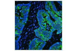 IF analysis of Cytokeratin 8 using anti-Cytokeratin 8 antibody (ABIN6719478). (KRT8 Antikörper  (AA 107-325))