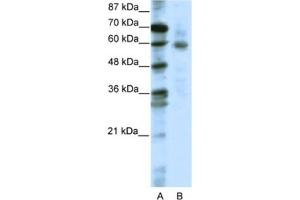 Western Blotting (WB) image for anti-Forkhead Box O1 (FOXO1) antibody (ABIN2461644) (FOXO1 Antikörper)