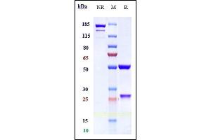 Anti-GCGR Reference Antibody (crotedumab) on SDS-PAGE under reducing (R) condition.