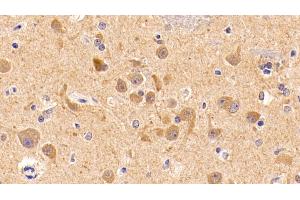 Immunohistochemistry (IHC) image for anti-Insulin-Like Growth Factor 1 (IGF1) (AA 49-118) antibody (ABIN7427897)