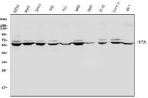 Western blot analysis of Wnt2b using anti-Wnt2b antibody (ABIN7602329).