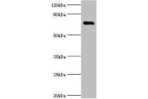 Western blot All lanes: Cartilage oligomeric matrix protein antibody at 4 μg/mL + Mouse skeletal muscle tissue Secondary Goat polyclonal to rabbit IgG at 1/10000 dilution Predicted band size: 83, 78 kDa Observed band size: 83 kDa (COMP Antikörper  (AA 20-160))