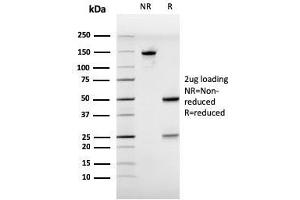 SDS-PAGE Analysis Purified Estrogen Receptor alpha Mouse Monoclonal Antibody (ESR1/3557). (Estrogen Receptor alpha Antikörper  (AA 129-312))