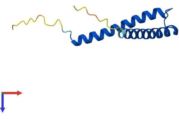 TIMM8A/DDP Protein (AA 1-97) (His tag)