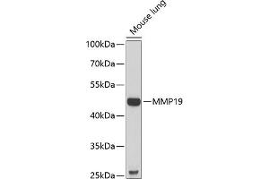 Western blot analysis of extracts of mouse lung, using MMP19 antibody (ABIN6132357, ABIN6143908, ABIN6143909 and ABIN6222356) at 1:1000 dilution. (MMP19 Antikörper  (AA 209-508))