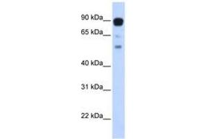 Image no. 1 for anti-Zinc Finger Protein 408 (ZNF408) (AA 648-697) antibody (ABIN6742883) (ZNF408 Antikörper  (AA 648-697))