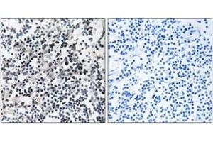 Immunohistochemistry analysis of paraffin-embedded human placenta tissue, using CDC37 (Ab-13) Antibody. (CDC37 Antikörper  (AA 1-50))