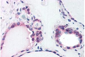 Human Thyroid (formalin-fixed, paraffin-embedded) stained with COPS2 antibody ABIN351473 at 3. (COPS2 Antikörper  (AA 439-451))