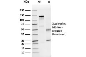 SDS-PAGE Analysis Purified Dystrophin Monospecific Mouse Monoclonal Antibody (DMD/3241). (Dystrophin Antikörper  (AA 114-263))