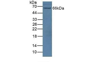 Detection of NOS1AP in Mouse Brain Tissue using Polyclonal Antibody to Nitric Oxide Synthase 1 Adaptor Protein (NOS1AP) (NOS1AP Antikörper  (AA 285-506))