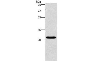 Western Blot analysis of Hela cell using BCL10 Polyclonal Antibody at dilution of 1:950 (BCL10 Antikörper)