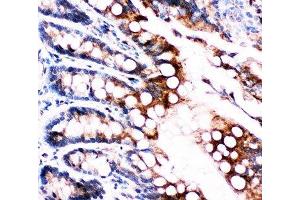 IHC-P: FABP5 antibody testing of rat intestine tissue