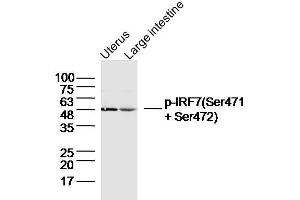 Lane 1: Mouse uterus lysates, Lane 2: Mouse large intestine lysates probed with IRF7 (Ser471 + Ser472) Polyclonal Antibody, unconjugated  at 1:300 overnight at 4°C followed by a conjugated secondary antibody for 60 minutes at 37°C. (IRF7 Antikörper  (pSer471, pSer472))