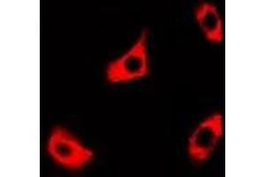 Immunofluorescent analysis of PPOX staining in A549 cells. (PPOX Antikörper)