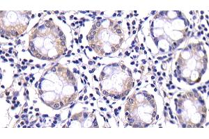 Immunohistochemistry (IHC) image for anti-Caspase 8 (CASP8) (AA 217-384) antibody (ABIN7432745)