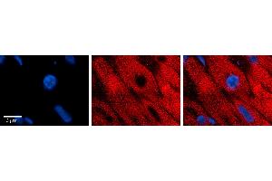 Immunohistochemistry (IHC) image for anti-Eukaryotic Translation Initiation Factor 2B, Subunit 2 Beta, 39kDa (EIF2B2) (Middle Region) antibody (ABIN2790211)