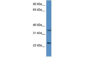 Mouse Thymus; WB Suggested Anti-Cyb5r1 Antibody. (CYB5R1 Antikörper  (N-Term))