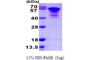 tau Protein (AA 1-412) (His tag)