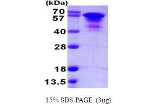 tau Protein (AA 1-412) (His tag)