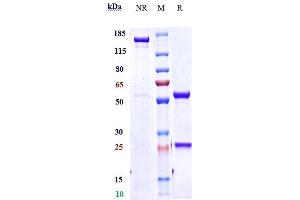 Anti-IL-4Ra / CD124 Reference Antibody (dupilumab) on SDS-PAGE under reducing (R) condition. (Rekombinanter IL-4RA (Dupilumab Biosimilar) Antikörper)
