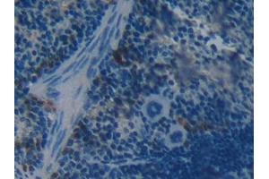 DAB staining on IHC-P; Samples: Mouse Spleen Tissue (BOC Antikörper  (AA 668-866))