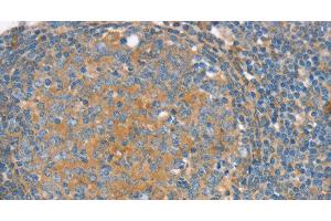 Immunohistochemistry of paraffin-embedded Human tonsil using SNX3 Polyclonal Antibody at dilution of 1:30 (Sorting Nexin 3 Antikörper)