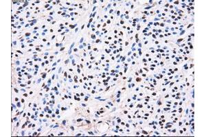 Immunohistochemical staining of paraffin-embedded liver tissue using anti-AKR1A1mouse monoclonal antibody. (AKR1A1 Antikörper)