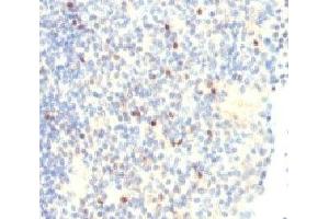 IHC analysis of FOXP3 antibody and human tonsil tissue. (FOXP3 Antikörper  (N-Term))