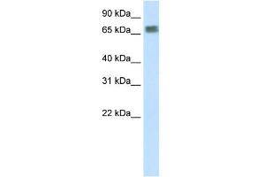 WB Suggested Anti-ZFP64 Antibody Titration:  2. (ZFP64 Antikörper  (N-Term))