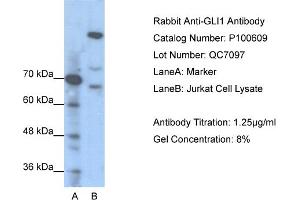 WB Suggested Anti-GLI1  Antibody Titration: 1. (GLI1 Antikörper  (N-Term))
