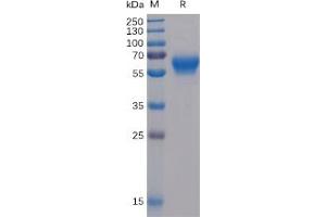 Human BTLA Protein, mFc-His Tag on SDS-PAGE under reducing condition.